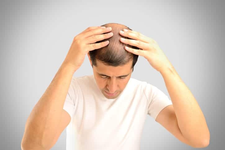 Hair Loss Treatment in San Diego, CA