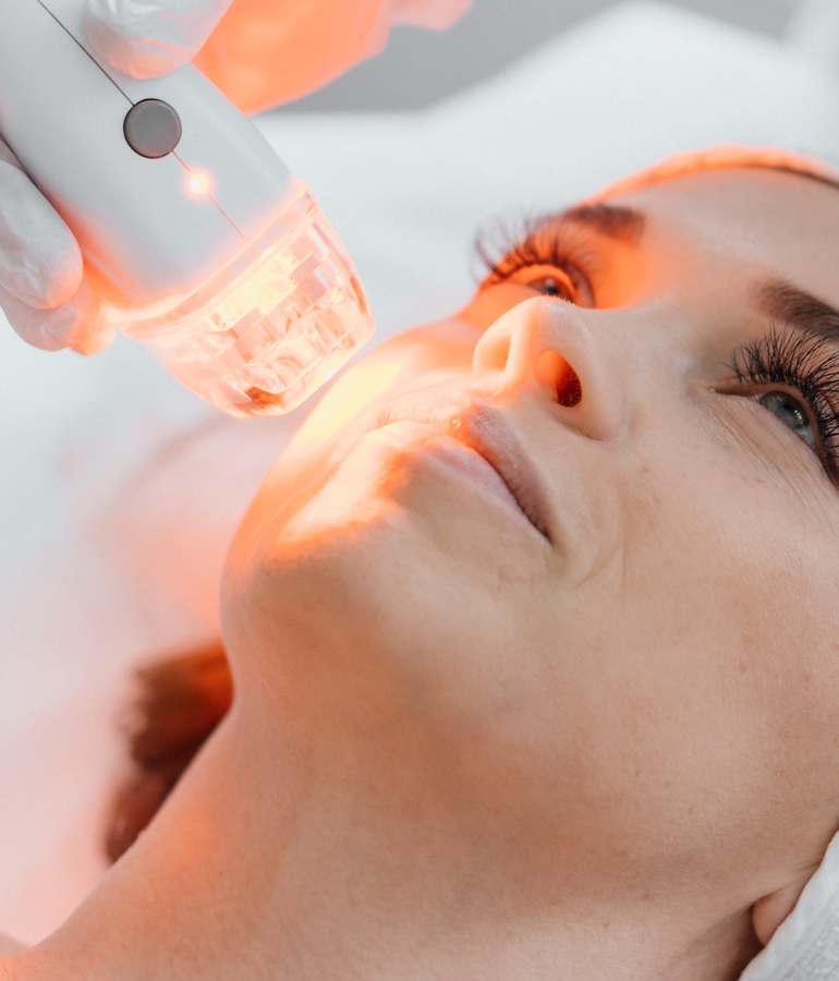 Red light laser lift on face | La Jolla Cosmetic Laser Clinic In San Diego