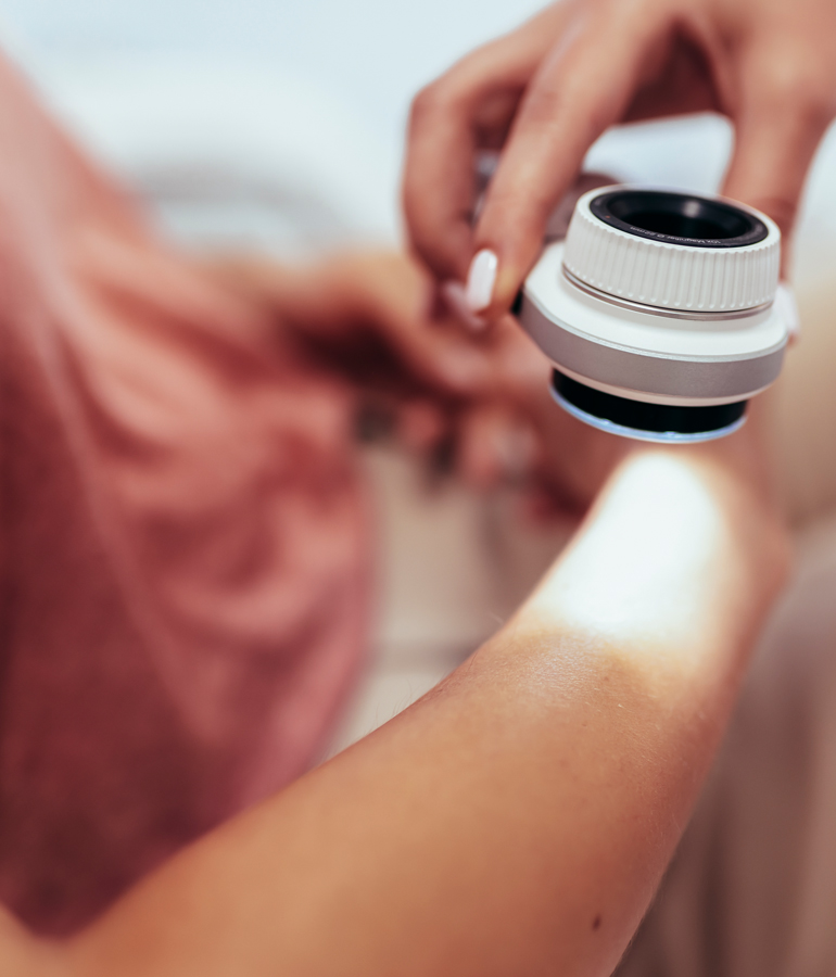 Mole Removal In San Diego | La Jolla Cosmetic Laser Clinic