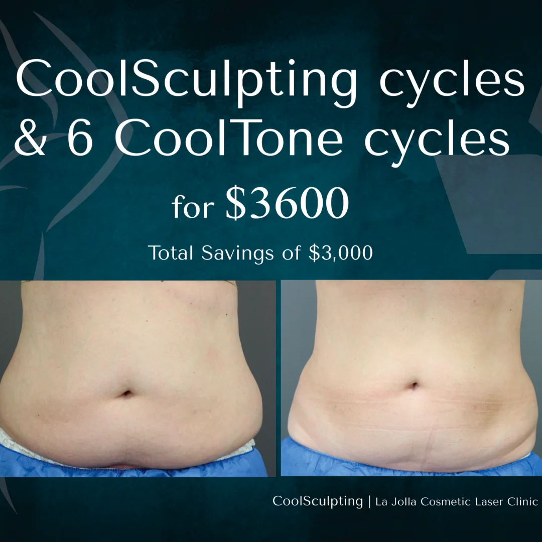 Coolsculpting Special Offer