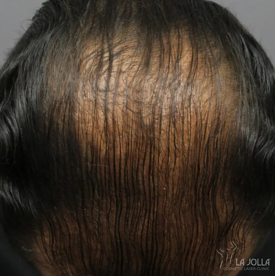 Regenerative Medicine