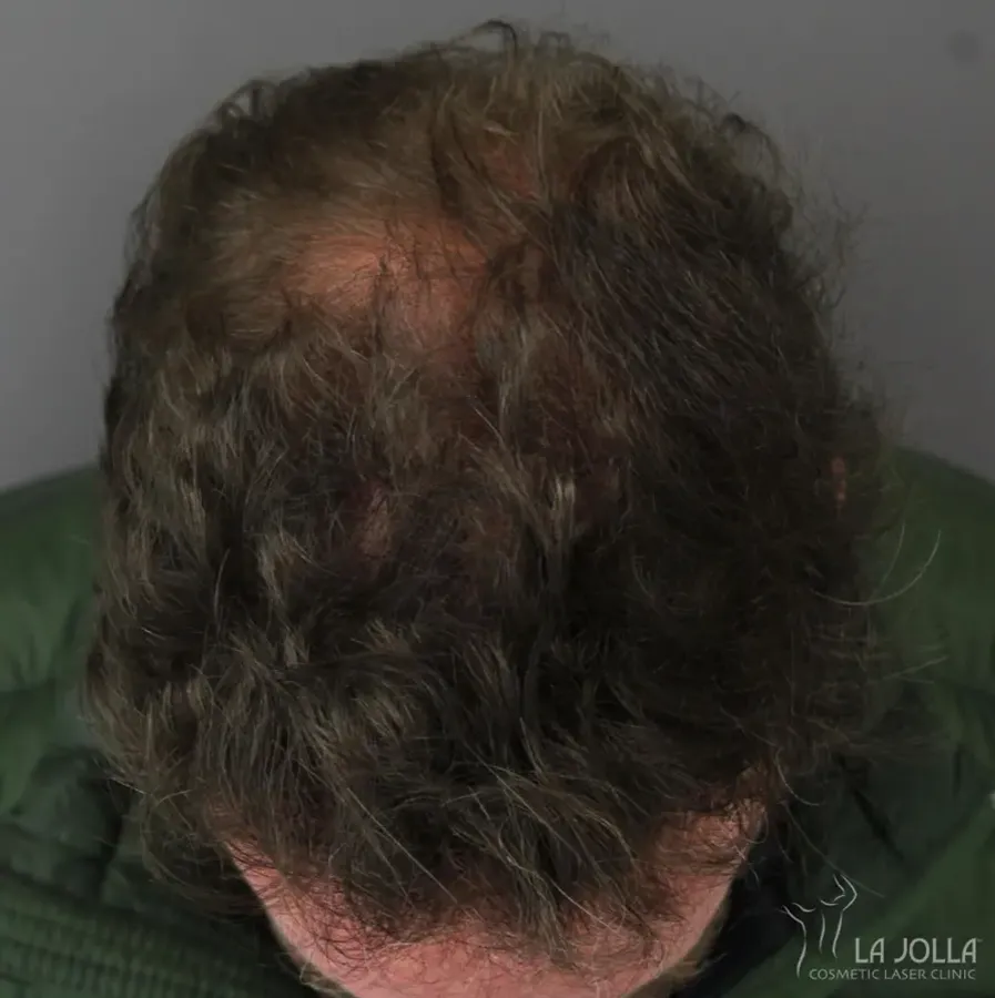 Regenerative Medicine