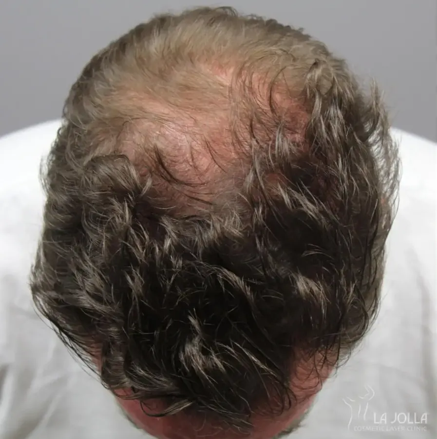 Regenerative Medicine