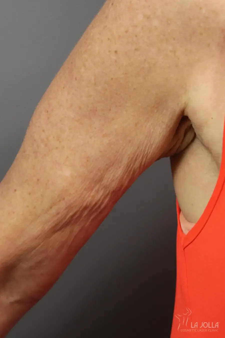 TightSculpting