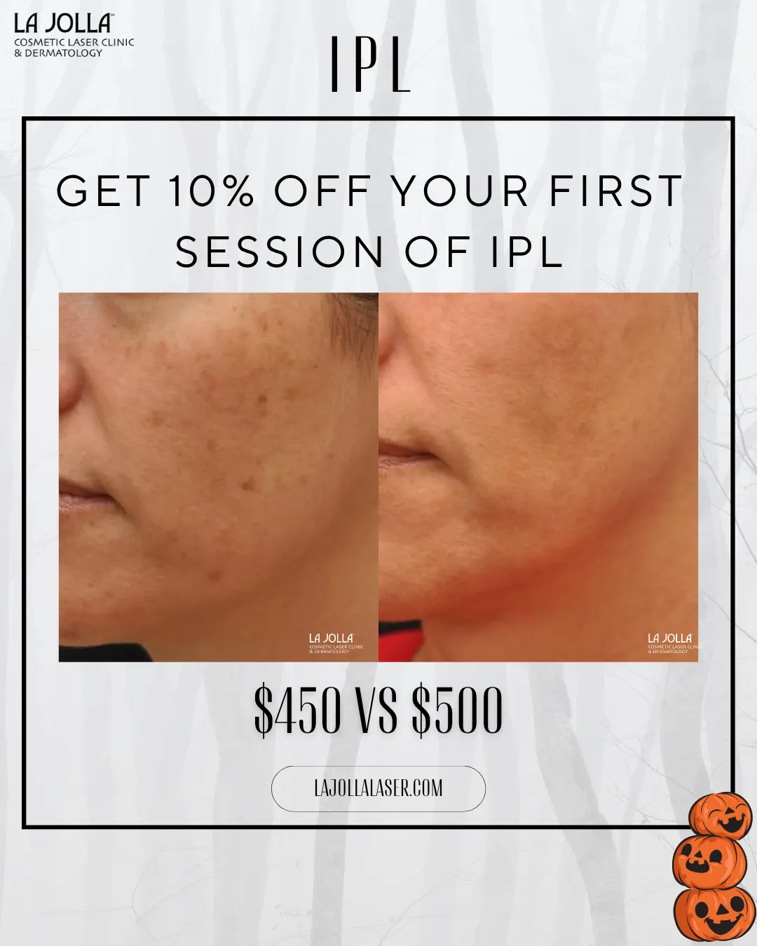 special-ipl