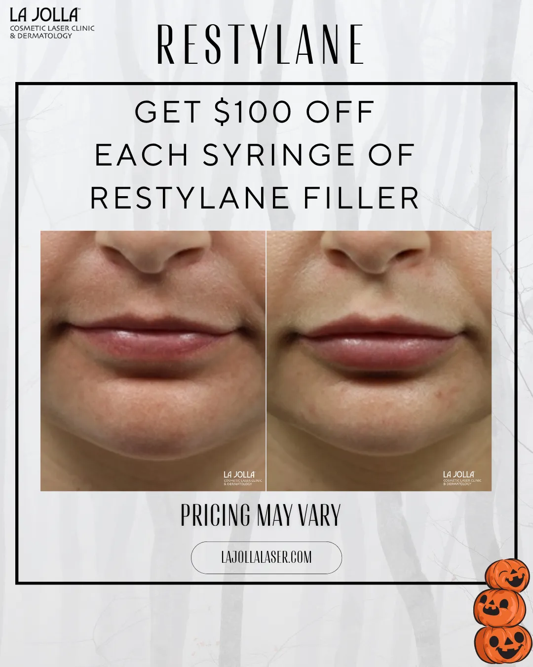 special-restylane