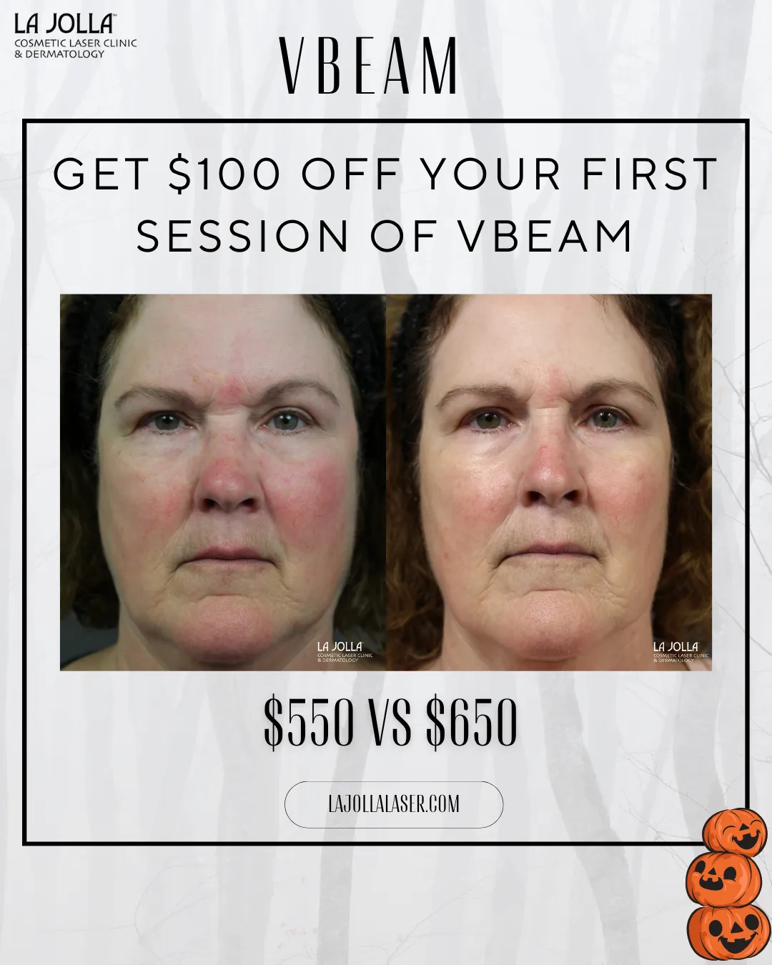 special-vbeam