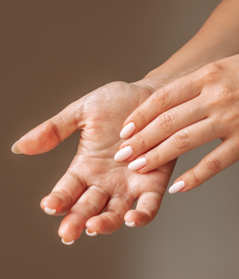 Image of hands exhibiting Hyperhidrosis.