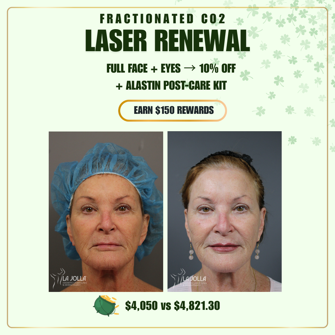 MARCH – FINAL FINAL