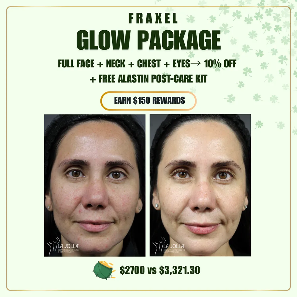 march-special-fraxel-4