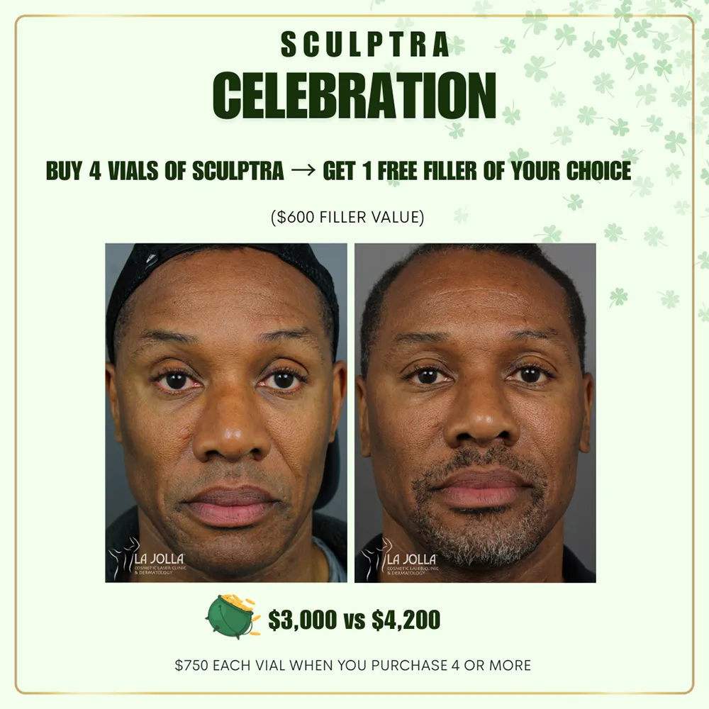 march-special-sculptra-1