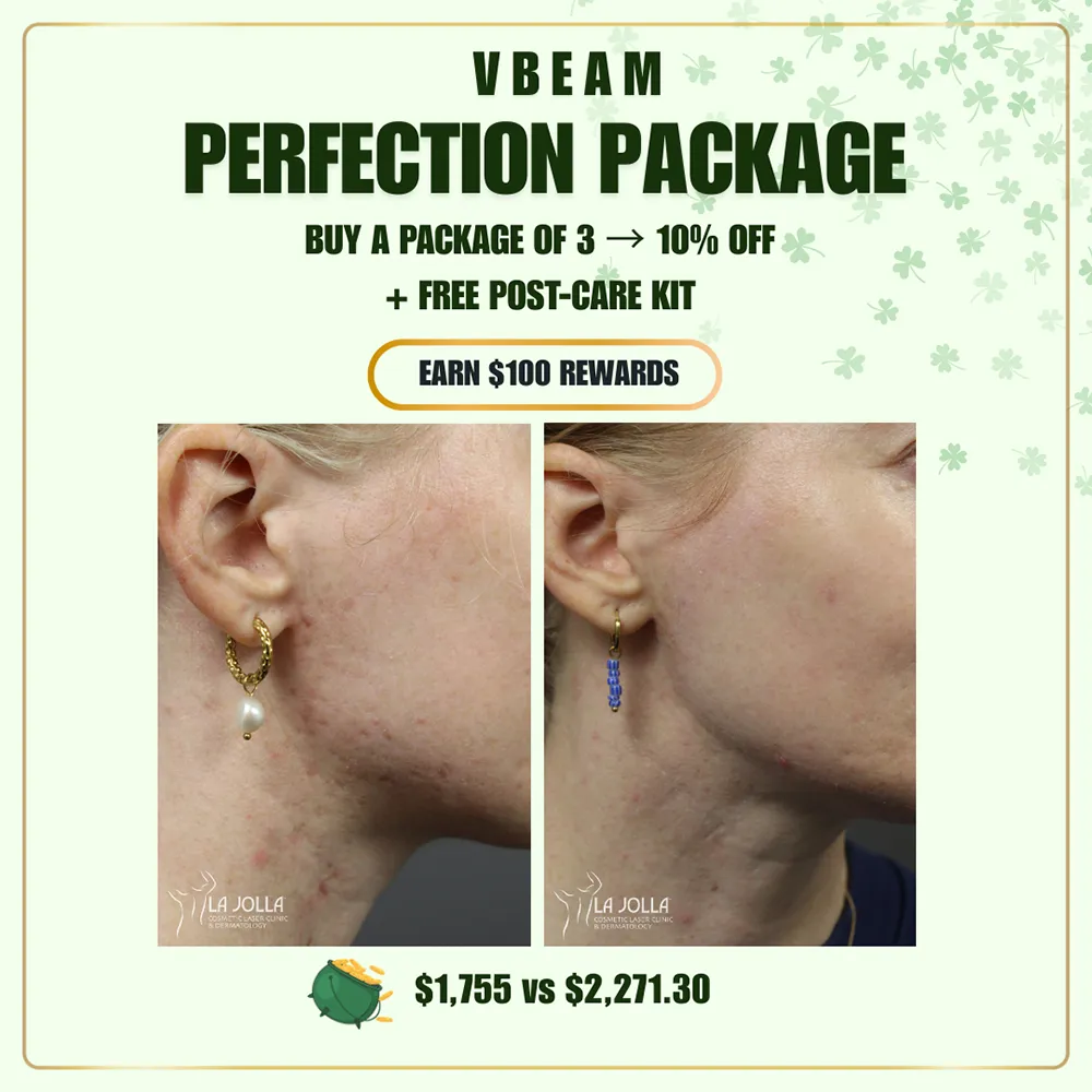 march-special-vbeam-7