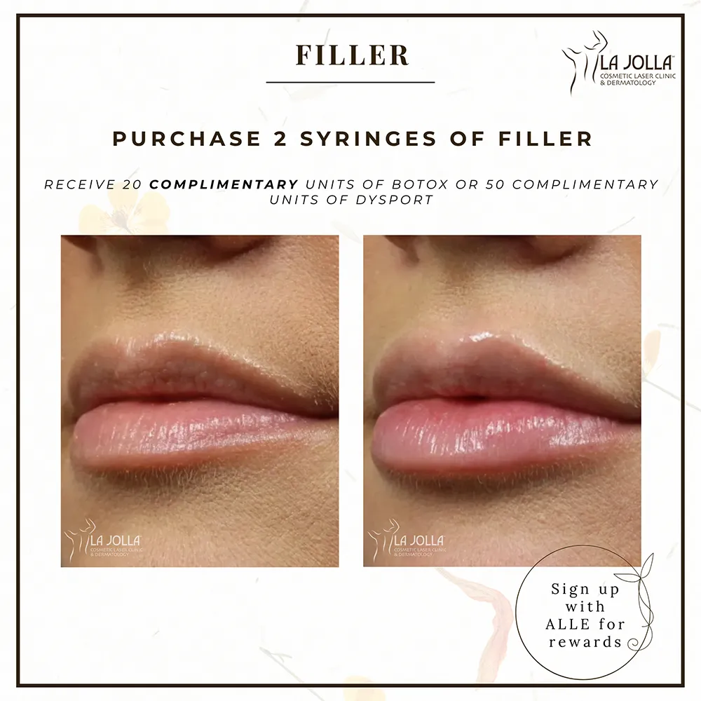 special-april-filler