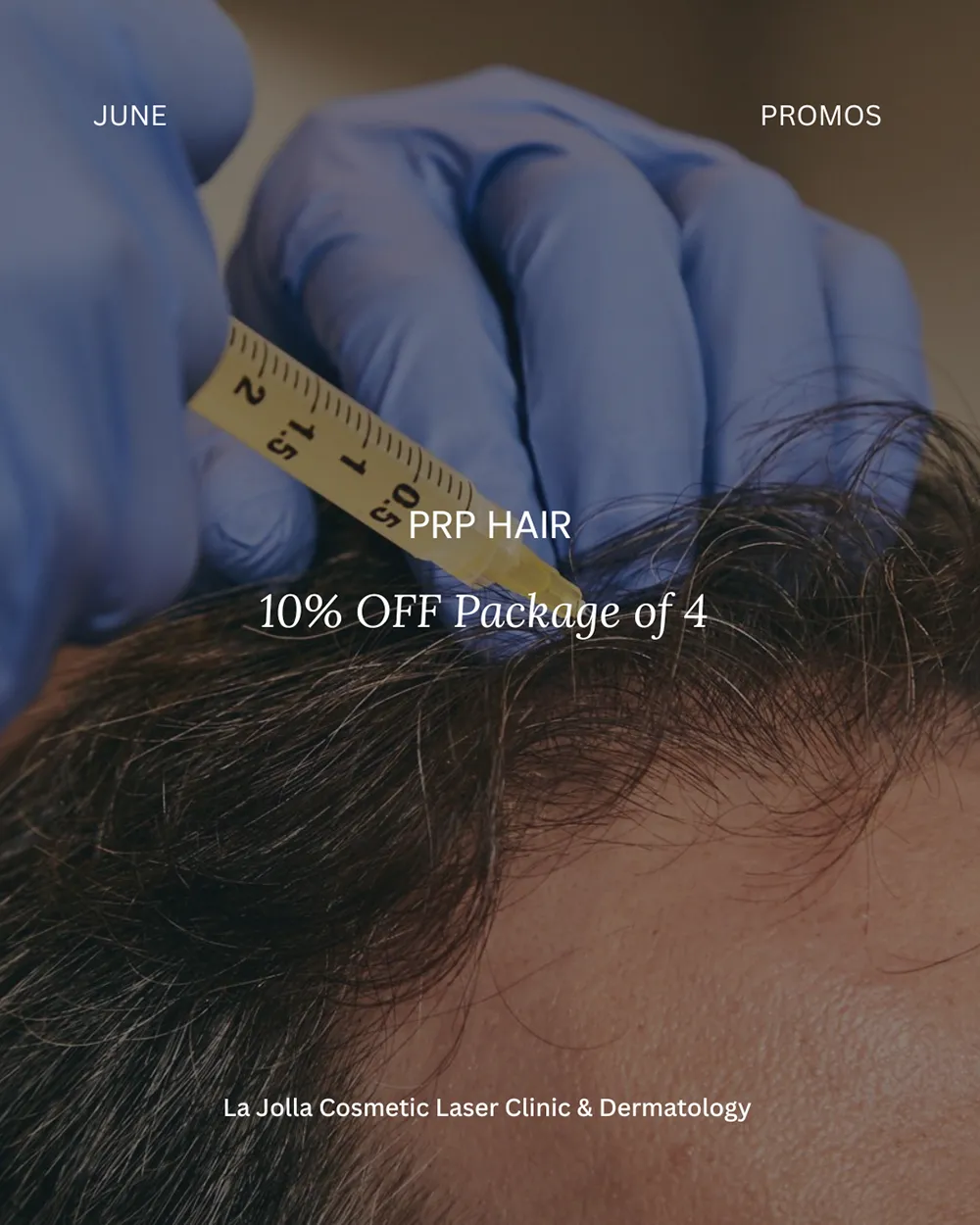 specials-prp-hair