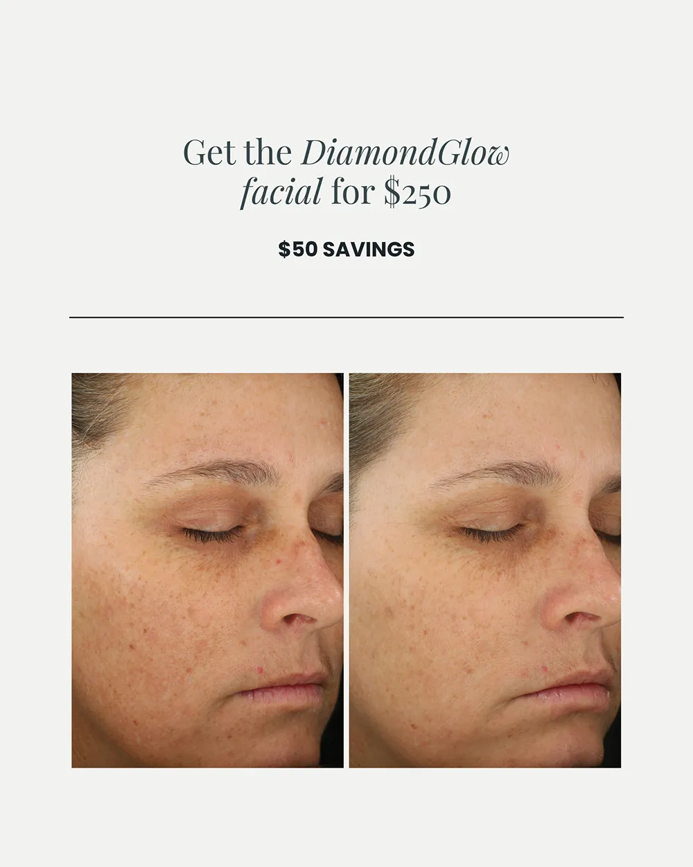 JULY PROMO_DiamondGlow facial