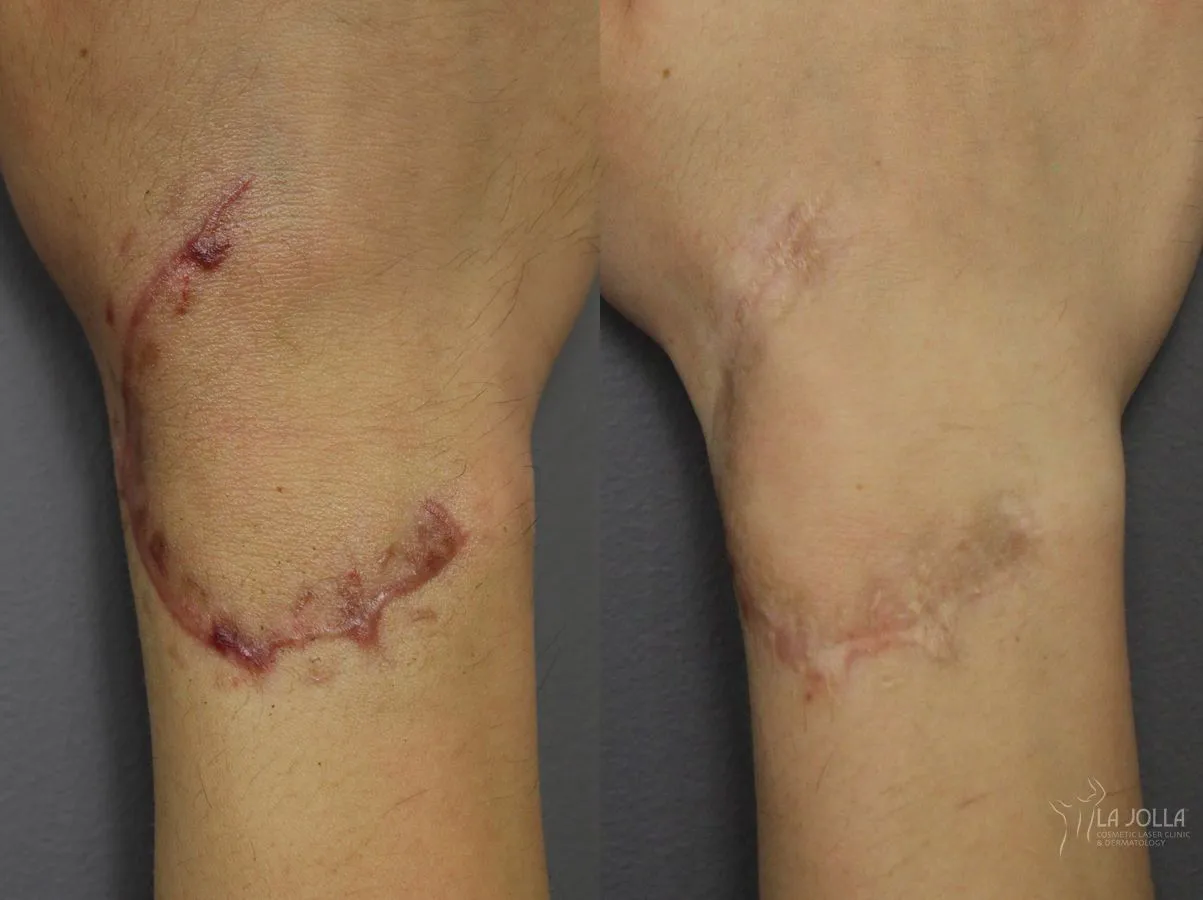 Scars – 5e223469-5b70-4275-a22b-6da88fecd456