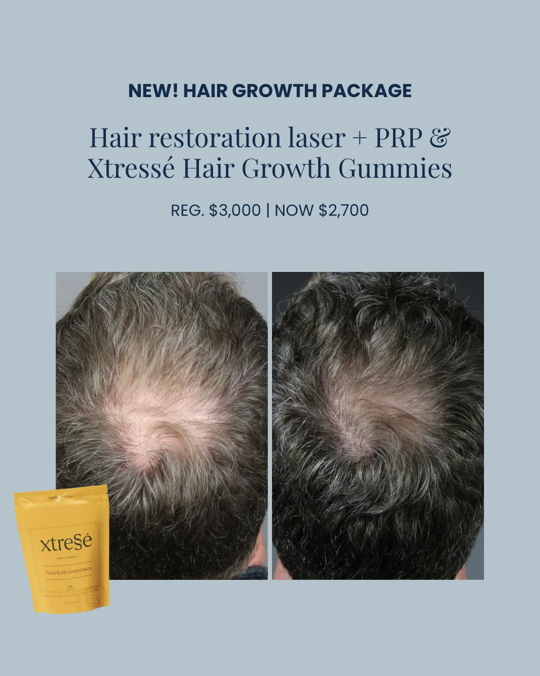 Hair Growth