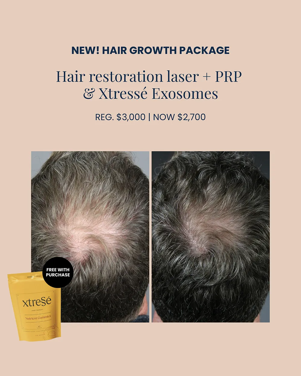 october-hair-growth